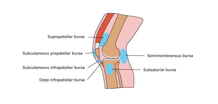 image showing knee bursitis