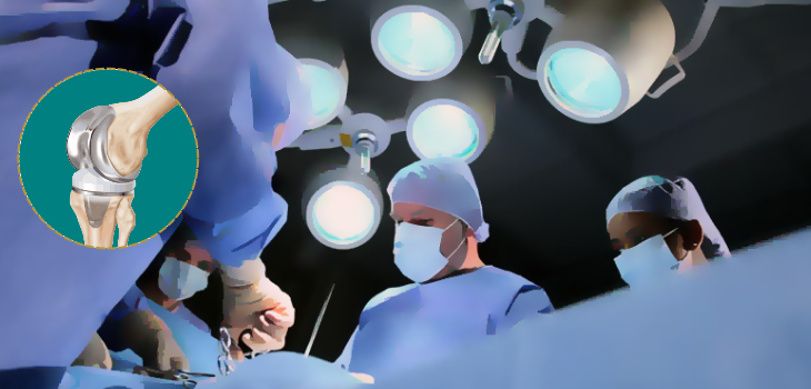Risks of knee replacement surgery