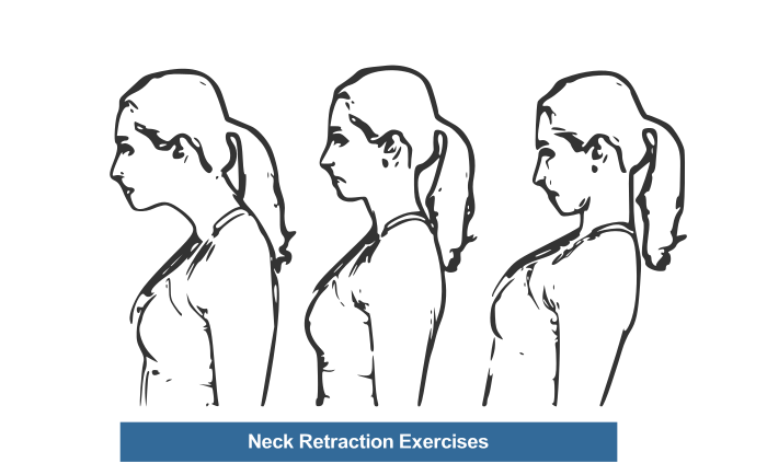 Cervical Spondylosis Exercise Chart