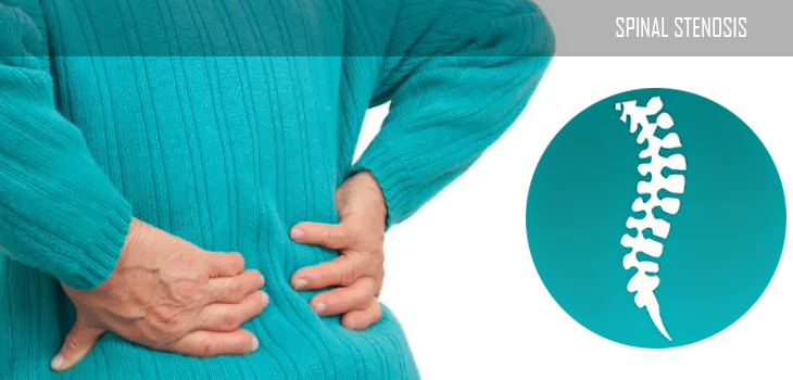 Cover image - Spinal stenosis