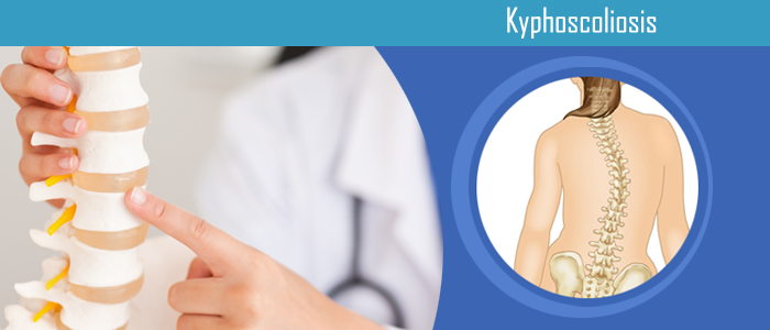 Kyphoscoliosis Spine