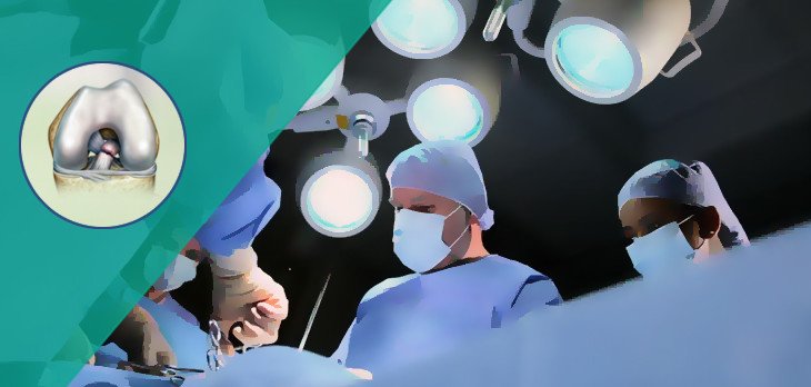 acl surgery