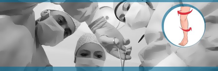 ACL Tear - ACL surgery Decision