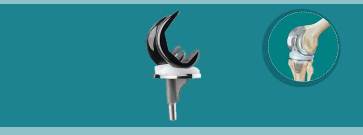 oxinium knee replacement