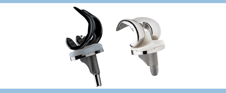Oxinium vs Cobalt-Chrome Prosthesis
