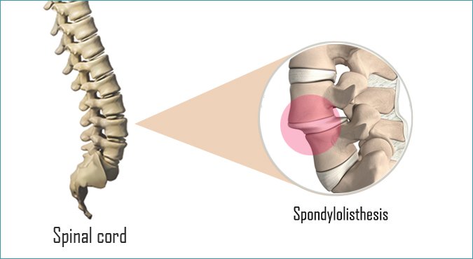 medical image compression thesis medical image compression thesis