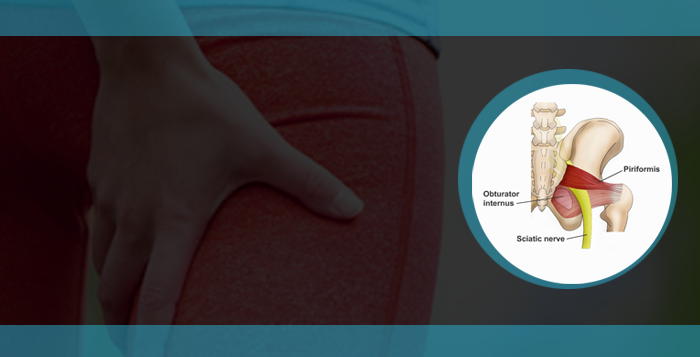Piriformis Stretching
