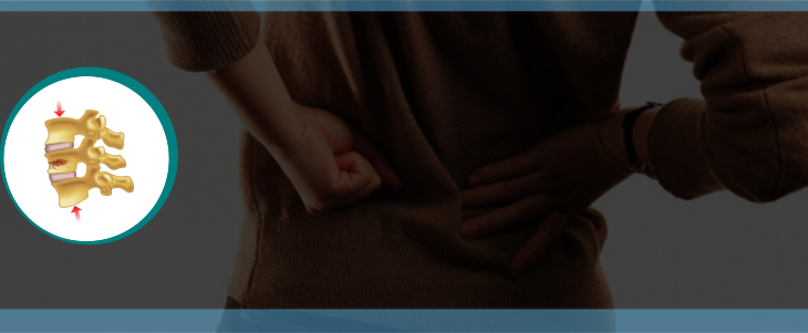 Spinal Stress Fractures