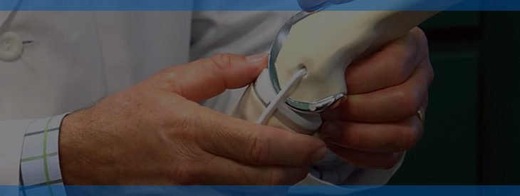 Wrong Reasons to Avoid Knee Replacement