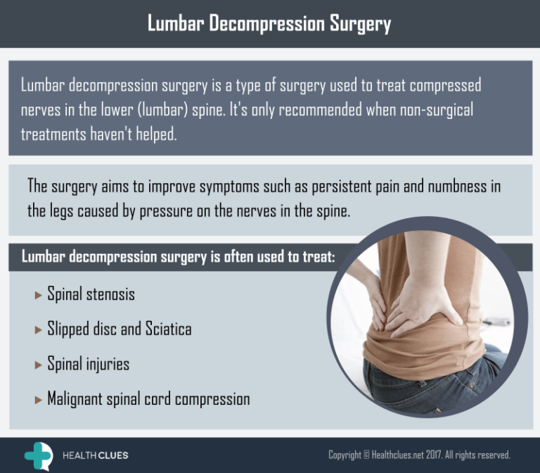 Lumbar surgery