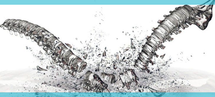 Osteoporosis - a silent killer of your bones