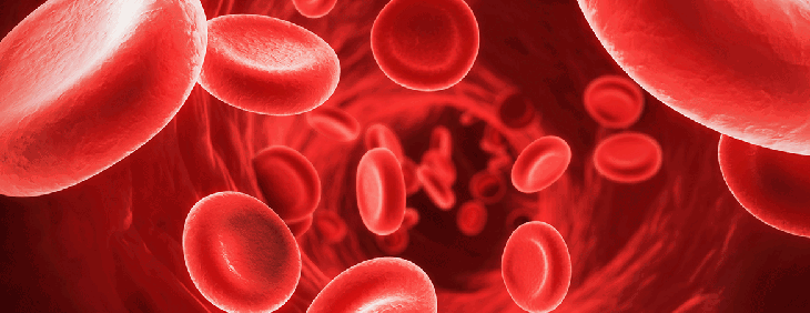 anemia caused by Rheumatoid