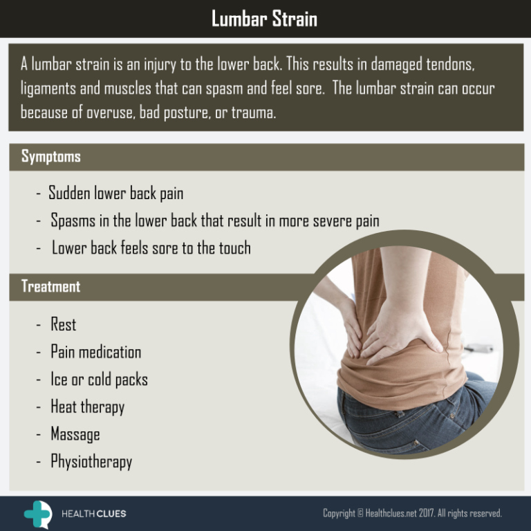 Lumbar Strain