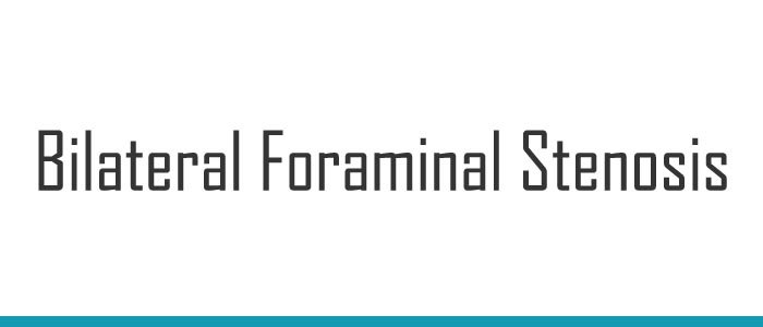 Bilateral Foraminal Stenosis