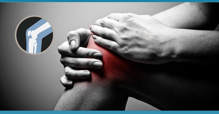 Knee Brace for Osteoarthritis