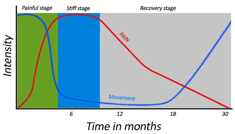 Frozen shoulder recovery chart Typical recovery stages for frozen shoulder