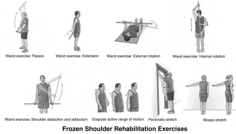 Frozen shoulder exercises Multiple exercises for shoulder joint