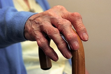 Physiotherapy and arthritis Physiotherapy can help delay serious symptoms