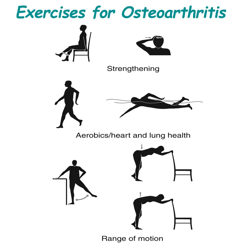 Arthritis | Treatment For Arthritis - Healthclues