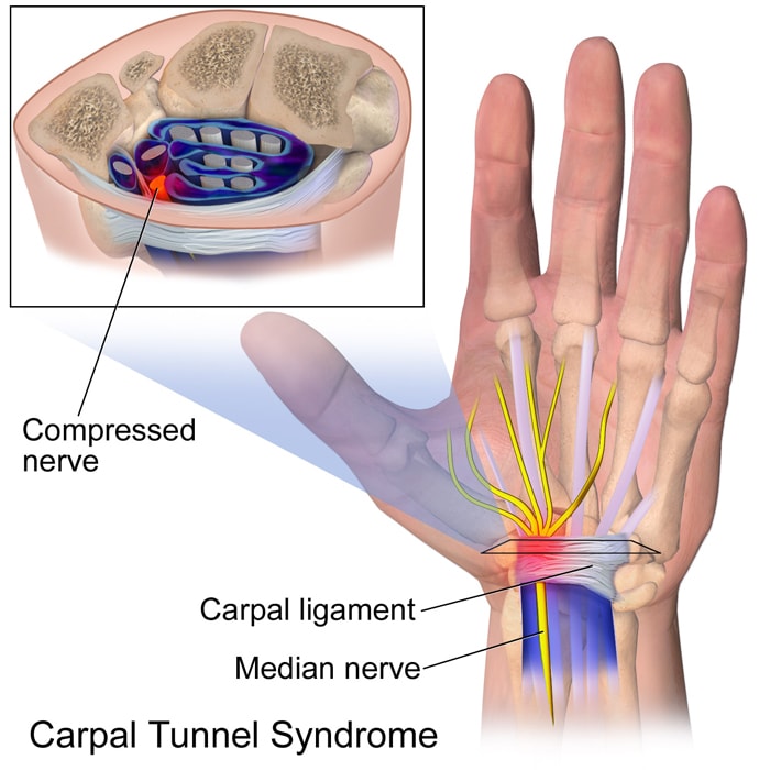 Wrist cross-section showing carpal tunnel Anatomy of wrist showing passageway for the median nerve