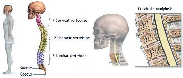cervical spine - the seven small vertebrae forming the neck. Diagram showing spine anatomy of Cervical spondylosis
