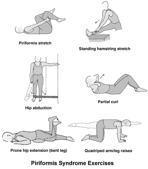 Physiotherapy to relieve sciatica Physiotherapy exercises for sciatica