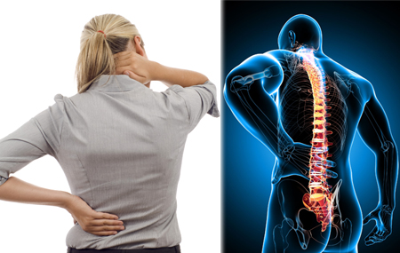 Spondylosis impacting back and neck Where spondylosis can attack