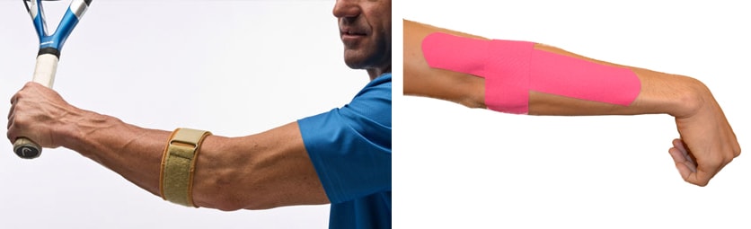 Conservative treatment options for tennis elbow Physiotherapy exercise for tennis elbow